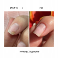 Nails Of The Day Olejek Przeciw Onycholizie Onistop 15 ml