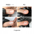 Nails Of The Day Olejek Przeciw Onycholizie Onistop 8 ml